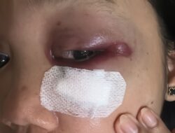 Mabes Polri Limpahkan Kasus KDRT Oknum Polisi Palembang ke Bidpropam Polda Sumsel