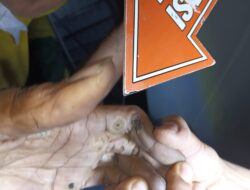 Petugas Mitra PLN Meninggal Dunia Tersengat Listrik Saat Perbaikan Jaringan di Pringgabaya