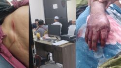 Paman Ditebas Parang, Dua Anggota Keluarga Malah Diproses Hukum