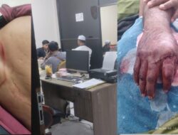 Paman Ditebas Parang, Dua Anggota Keluarga Malah Diproses Hukum